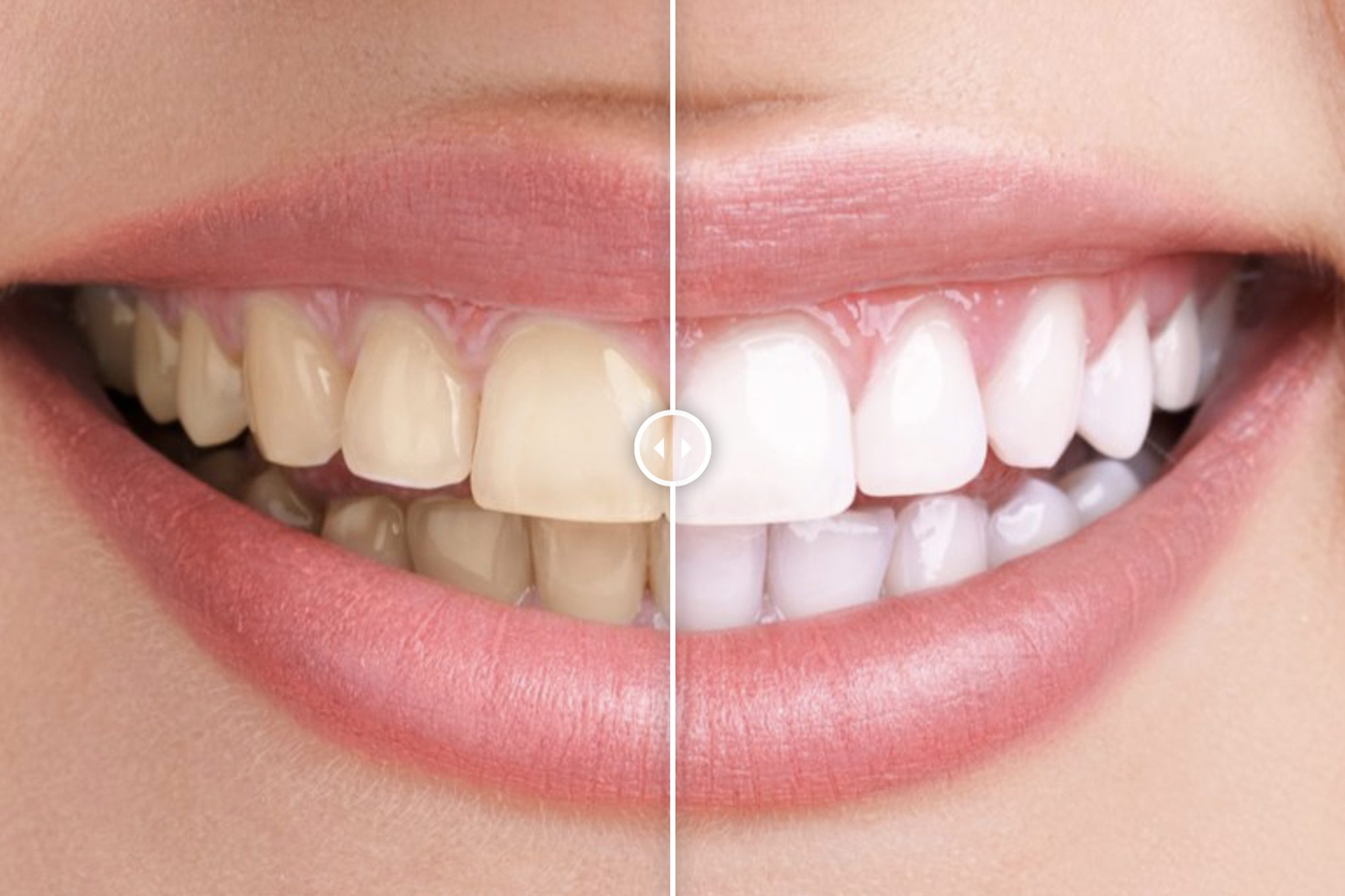 Before & After Images Comparison WordPress Plugin plugin cover image